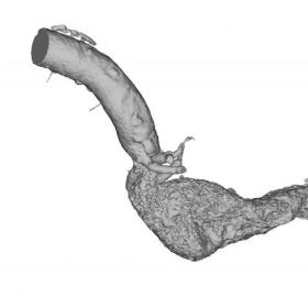 Il modello di aorta ©PromFacility