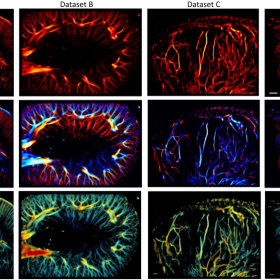 Dataset preclinici: Ricostruzione del sistema vascolare ricavata utilizzando migliaia di immagini al secondo