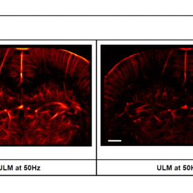 Dataset preclinici: L’immagine mette a confronto due scansioni ottenute con tecnologia Teulm e Ulm