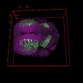 Neurons (green) and all cell nuclei (purple) ©MatthiasCarl, UniTrento