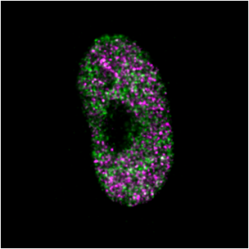nucleo della cellula con distribuzione della BRD4 (in verde) e della proteina BMI1 (in viola)