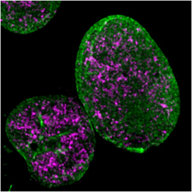 nucleo della cellula con la proteina Lamina A/C (in verde) e la proteina BMI1 (in viola)