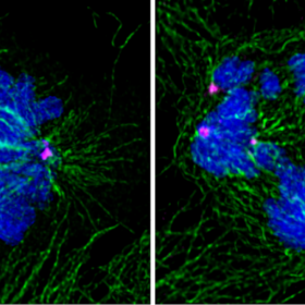 Cellule umane in mitosi (DNA in blu, microtubuli in verde e i centrosomi in magenta)